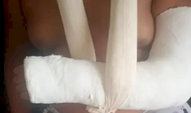 Aluno autista tem braço quebrado ao ser agredido em escola de Rio Preto