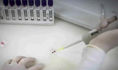 Paciente em SP com suspeita de ebola testa positivo para meningite