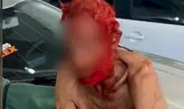 Empresário vira réu por pintar cabelo e barba de idoso de 83 anos de vermelho