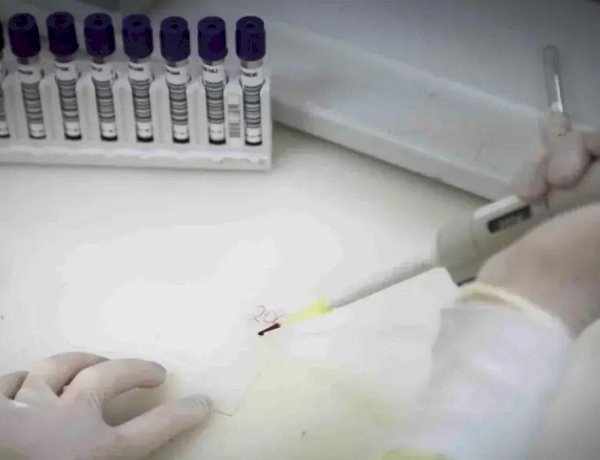Paciente em SP com suspeita de ebola testa positivo para meningite