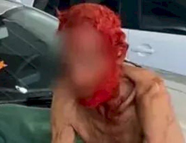 Empresário vira réu por pintar cabelo e barba de idoso de 83 anos de vermelho