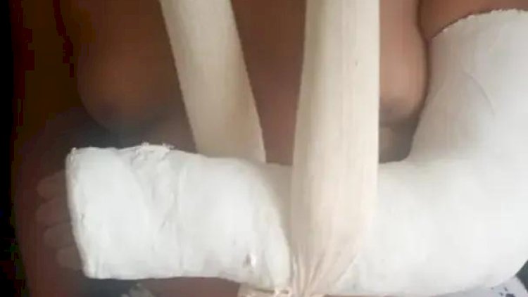 Aluno autista tem braço quebrado ao ser agredido em escola de Rio Preto