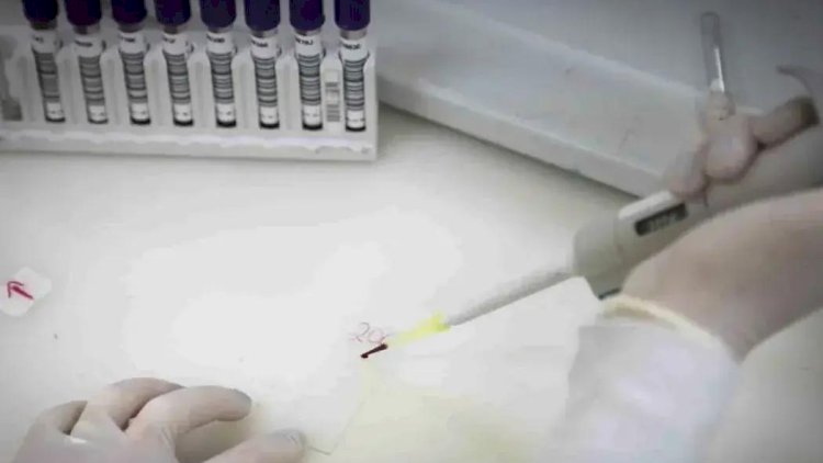 Paciente em SP com suspeita de ebola testa positivo para meningite