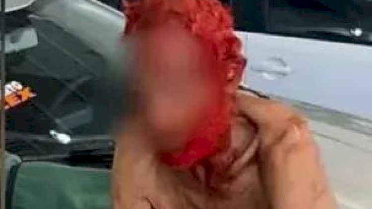 Empresário vira réu por pintar cabelo e barba de idoso de 83 anos de vermelho