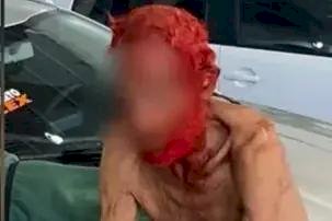 Empresário vira réu por pintar cabelo e barba de idoso de 83 anos de vermelho